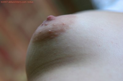 Puntige borsten en ronde gezwollen tepels bij jong meisje