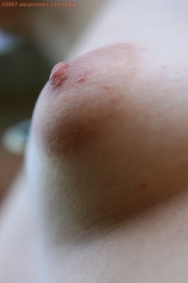 Puntige borsten en ronde gezwollen tepels bij jong meisje