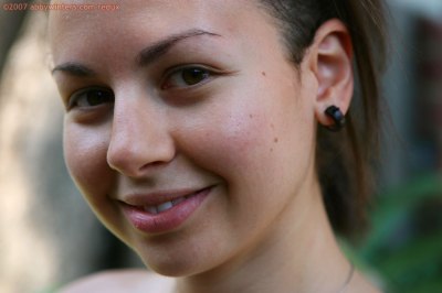 Puntige borsten en ronde gezwollen tepels bij jong meisje