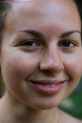 Puntige borsten en ronde gezwollen tepels bij jong meisje